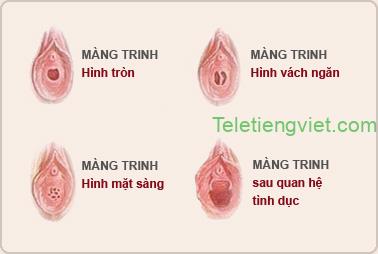 Vị trí màng trinh 